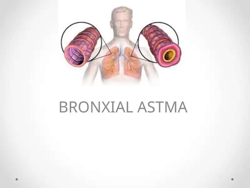 BRONXIAL ASTMA 1
