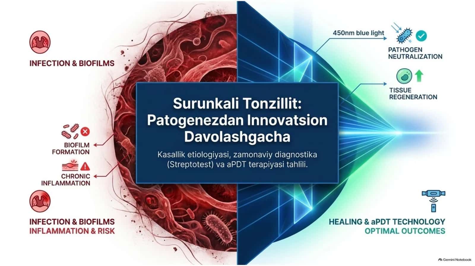 Surunkaliy tonzilit 1