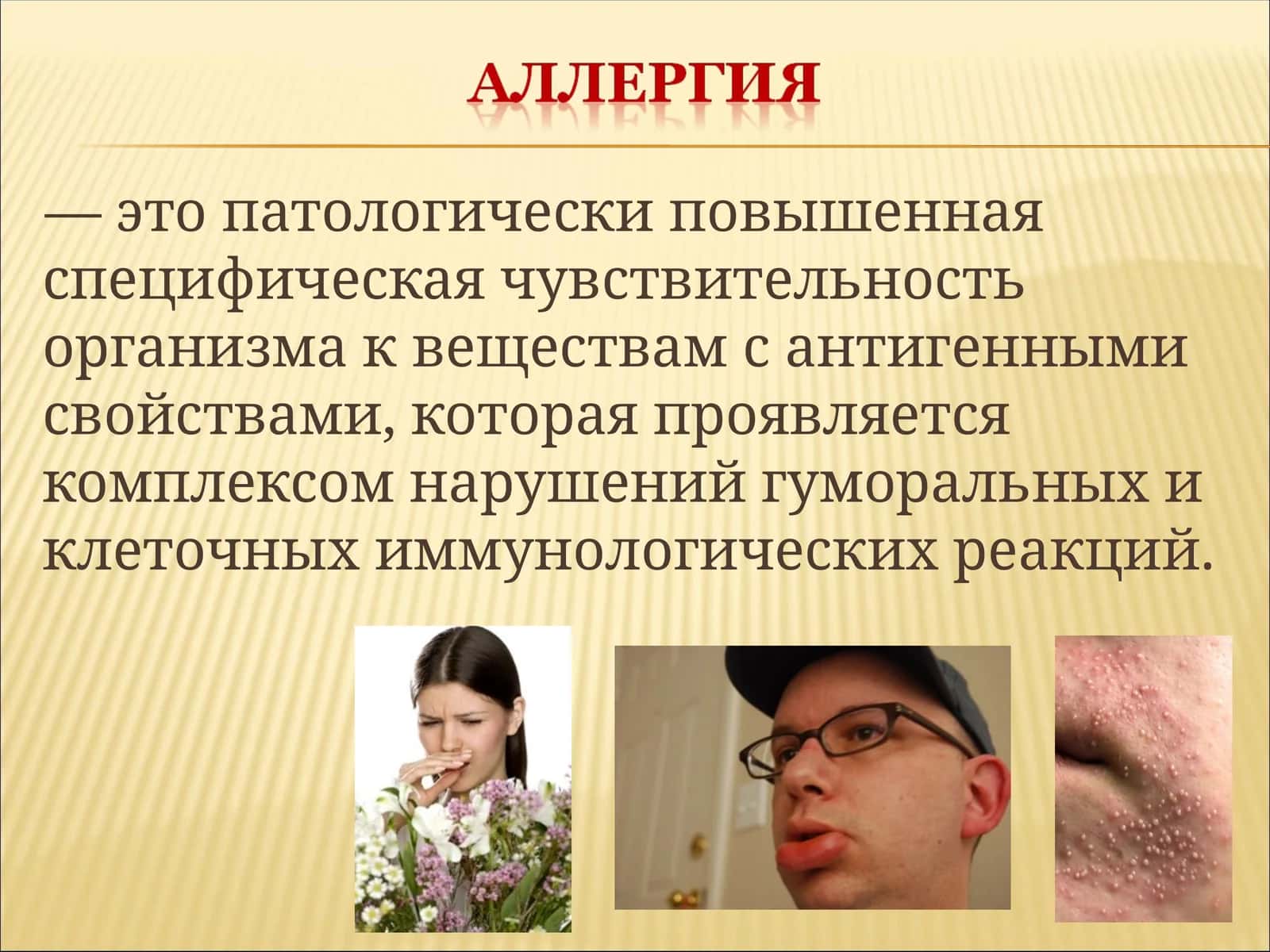 Аллергия 1