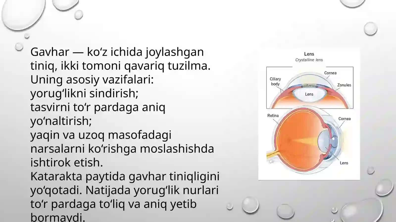 ORTTIRILGAN KATARAKTA 3