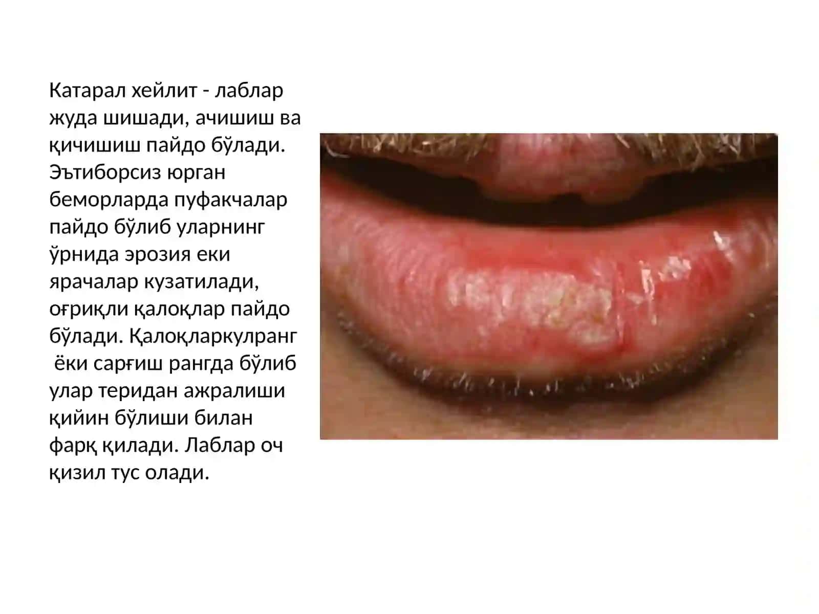 Хейлитлар 3