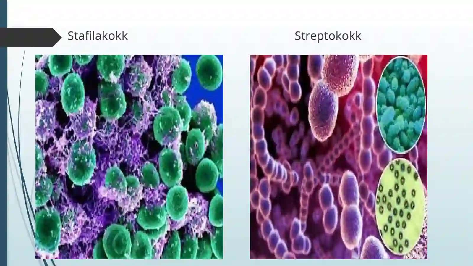 Sepsis 3