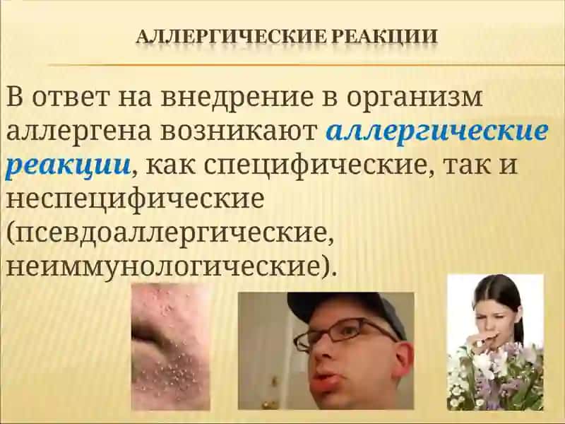 Аллергия 3