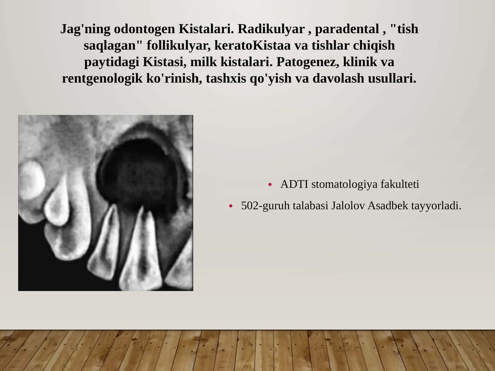 Jag'ning odontogenKistalari
