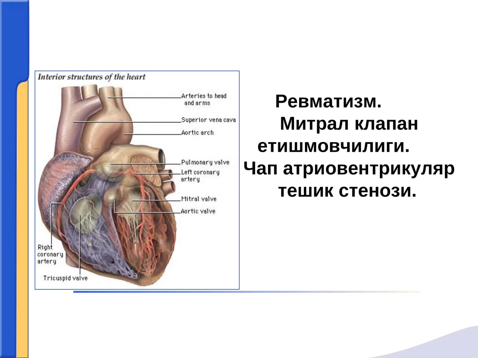 Ревматизм (Сокольский-Буйо касаллиги)