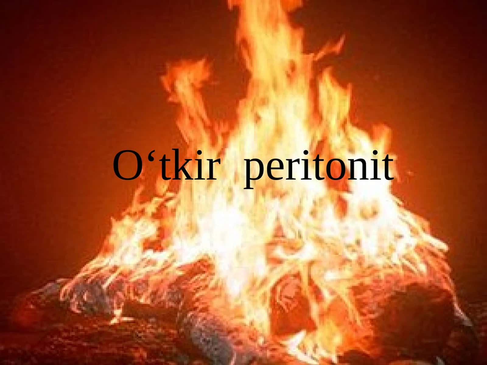O‘tkir peritonit