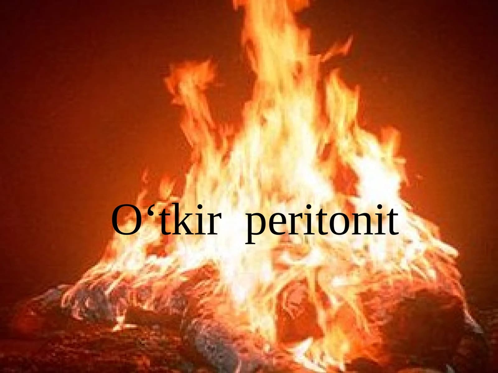 O'tkir peritonit